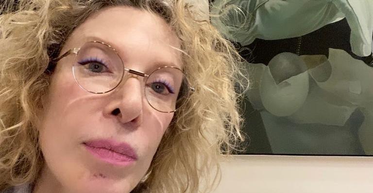 Marília Gabriela passa por cirurgia para retirada de câncer de pele