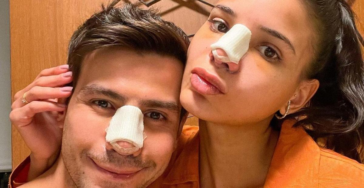 Jakelyne Oliveira e Mariano exibem antes e depois de rinoplastia e celebram: ”O melhor possível!”