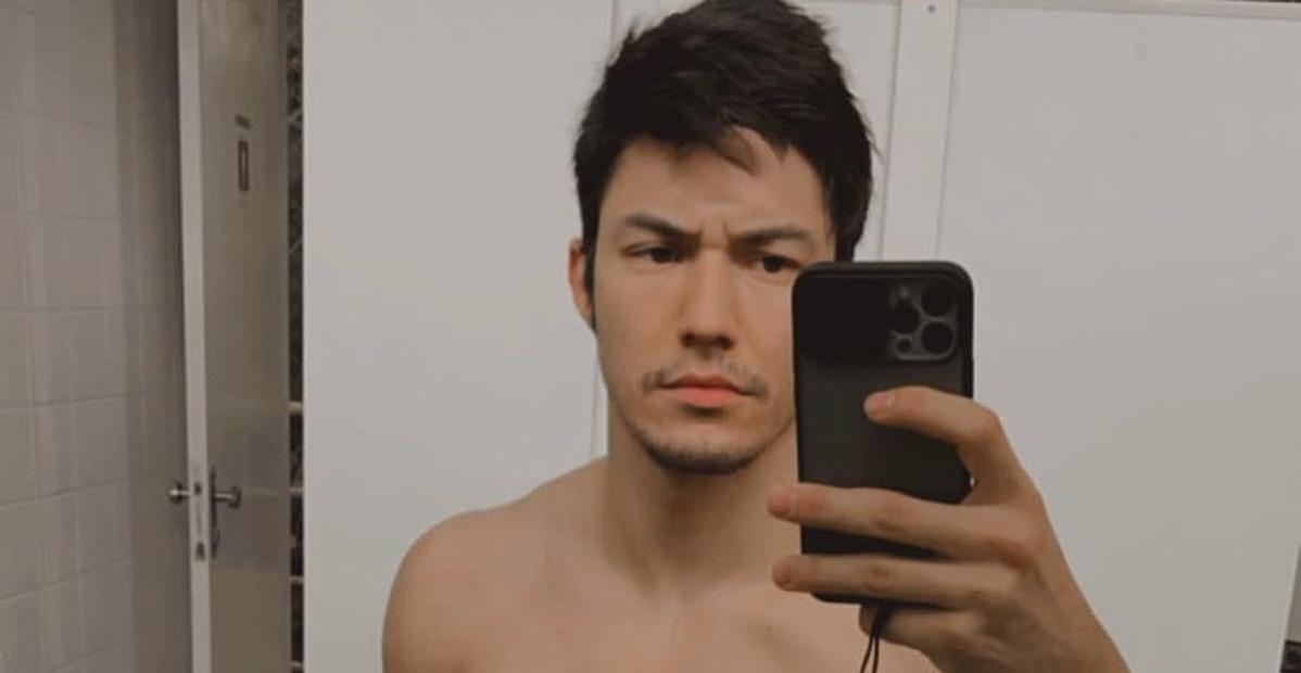 Arthur Nory sofre acidente em barra e fratura o nariz: ”3 dias já volto”