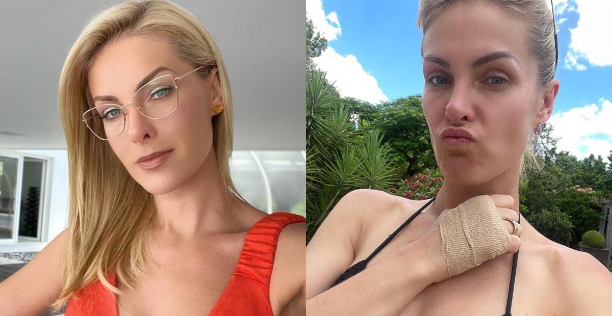 Ana Hickmann sofre acidente ao colher mangas: ‘Resultado foi um corte na mão e vacina antitetânica’